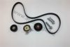 AUTOMEGA 1016060306 Timing Belt Kit